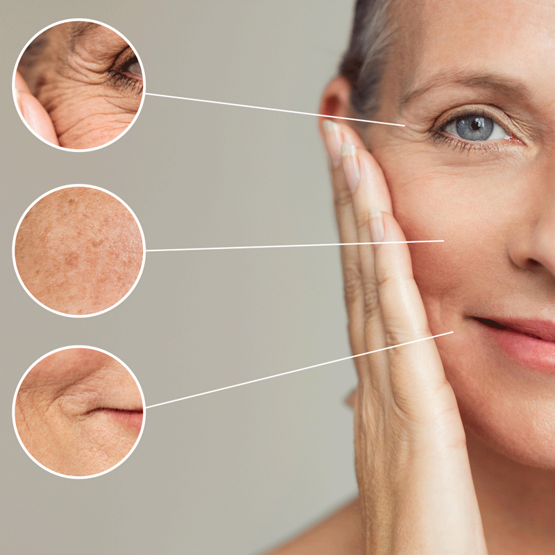 Anti Aging
